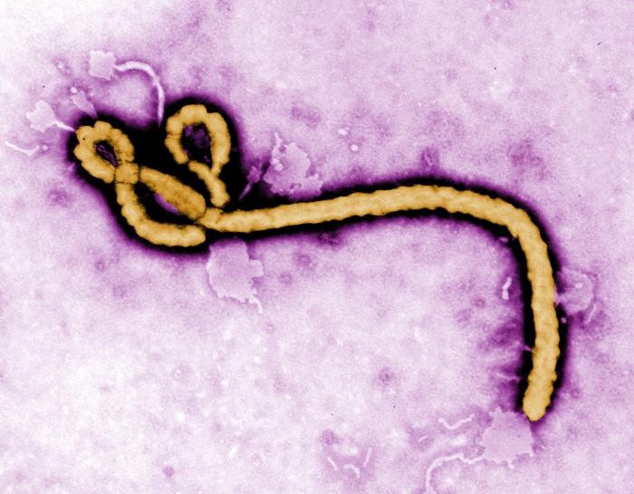 Вирус Эболы под электронным микроскопом. Иллюстрация: CDC/Frederick A. Murphy
